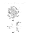 SURFACE TREATING APPARATUS AND METHOD diagram and image