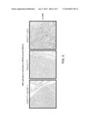 Methods Of Predicting Response To JNK Inhibitor Therapy diagram and image