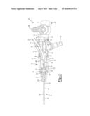 SINUS ENDOSCOPE diagram and image