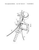 SURGICAL ACCESS SYSTEM AND RELATED METHODS diagram and image