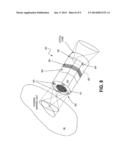 PHOTOACOUSTIC IMAGING DEVICES AND METHODS OF IMAGING diagram and image