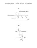 MEASUREMENT APPARATUS, MEASUREMENT METHOD, PROGRAM, STORAGE MEDIUM, AND     MEASUREMENT SYSTEM diagram and image