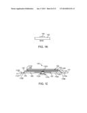 METHOD AND APPARATUS TO MEASURE BIOELECTRIC IMPEDANCE OF PATIENT TISSUE diagram and image