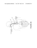 ABLATION AND TEMPERATURE MEASUREMENT DEVICES diagram and image