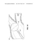 CATHETER BALLOON EMPLOYING FORCE SENSING ELEMENTS diagram and image