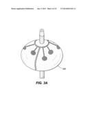 CATHETER BALLOON EMPLOYING FORCE SENSING ELEMENTS diagram and image