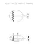 CATHETER BALLOON EMPLOYING FORCE SENSING ELEMENTS diagram and image