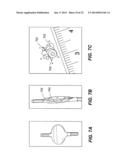 CATHETER BALLOON EMPLOYING FORCE SENSING ELEMENTS diagram and image