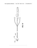 CATHETER BALLOON EMPLOYING FORCE SENSING ELEMENTS diagram and image