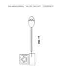 CATHETER BALLOON EMPLOYING FORCE SENSING ELEMENTS diagram and image