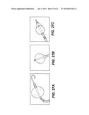 CATHETER BALLOON EMPLOYING FORCE SENSING ELEMENTS diagram and image