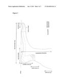 GRADUATED COMPRESSION GARMENTS diagram and image