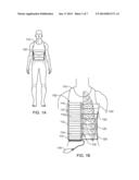 Contour Bracing diagram and image