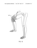 Contour Bracing diagram and image