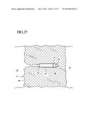 Implant Delivery Catheter System And Methods For Its Use diagram and image