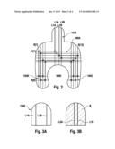 MOISTURE SENSOR FOR MONITORING AN ACCESS TO A PATIENT AND METHOD OF     PRODUCING THE MOISTURE SENSOR diagram and image