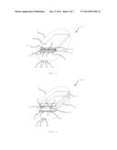 MEDICAL DEVICE WITH AN ENERGY SUPPLY CARRYING A RESERVOIR diagram and image