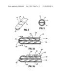 Valved Tip Catheters diagram and image