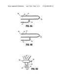 Valved Tip Catheters diagram and image