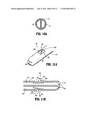 Valved Tip Catheters diagram and image