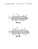 Valved Tip Catheters diagram and image