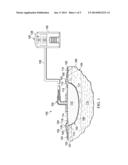 SYSTEMS, METHODS, AND DEVICES FOR TREATING A TISSUE SITE ON A MAMMAL     HAVING HAIR PROXIMATE THE TISSUE SITE diagram and image