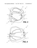 Protective Underwear With Absorbent Insert diagram and image