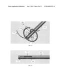 ABLATION DEVICES AND METHODS diagram and image