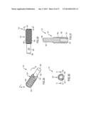 IMPLANTABLE DEVICE WITH LOCKING ADJUSTMENT MECHANISM AND METHOD FOR USING     SAME diagram and image