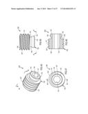 IMPLANTABLE DEVICE WITH LOCKING ADJUSTMENT MECHANISM AND METHOD FOR USING     SAME diagram and image