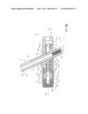 IMPLANTABLE DEVICE WITH LOCKING ADJUSTMENT MECHANISM AND METHOD FOR USING     SAME diagram and image