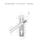 IMPLANTABLE DEVICE WITH LOCKING ADJUSTMENT MECHANISM AND METHOD FOR USING     SAME diagram and image