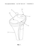 SYSTEM AND METHOD FOR JOINT RESURFACING AND REPAIR diagram and image