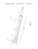 SYSTEM AND METHOD FOR JOINT RESURFACING AND REPAIR diagram and image