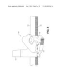 LOCKING DISTRACTOR WITH TWO-START DISTRACTION SCREW diagram and image