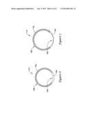 EXPANDABLE GUIDE EXTENSION CATHETER diagram and image