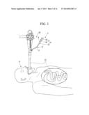 ENDOSCOPE TREATMENT TOOL diagram and image