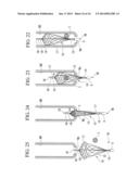 ENDOSCOPE TREATMENT TOOL diagram and image