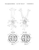 REMOTELY ACTUATED SURGICAL GRIPPER WITH SEIZE RESISTANCE diagram and image