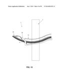 METHOD AND APPARATUS FOR PASSING SUTURE THROUGH TISSUE diagram and image