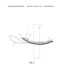 METHOD AND APPARATUS FOR PASSING SUTURE THROUGH TISSUE diagram and image