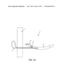 METHOD AND APPARATUS FOR PASSING SUTURE THROUGH TISSUE diagram and image