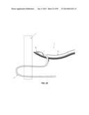 METHOD AND APPARATUS FOR PASSING SUTURE THROUGH TISSUE diagram and image