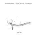 METHOD AND APPARATUS FOR PASSING SUTURE THROUGH TISSUE diagram and image