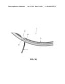 METHOD AND APPARATUS FOR PASSING SUTURE THROUGH TISSUE diagram and image