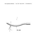 METHOD AND APPARATUS FOR PASSING SUTURE THROUGH TISSUE diagram and image