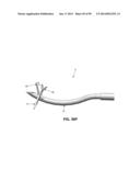 METHOD AND APPARATUS FOR PASSING SUTURE THROUGH TISSUE diagram and image