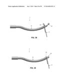 METHOD AND APPARATUS FOR PASSING SUTURE THROUGH TISSUE diagram and image