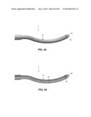 METHOD AND APPARATUS FOR PASSING SUTURE THROUGH TISSUE diagram and image