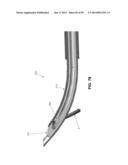 METHOD AND APPARATUS FOR PASSING SUTURE THROUGH TISSUE diagram and image